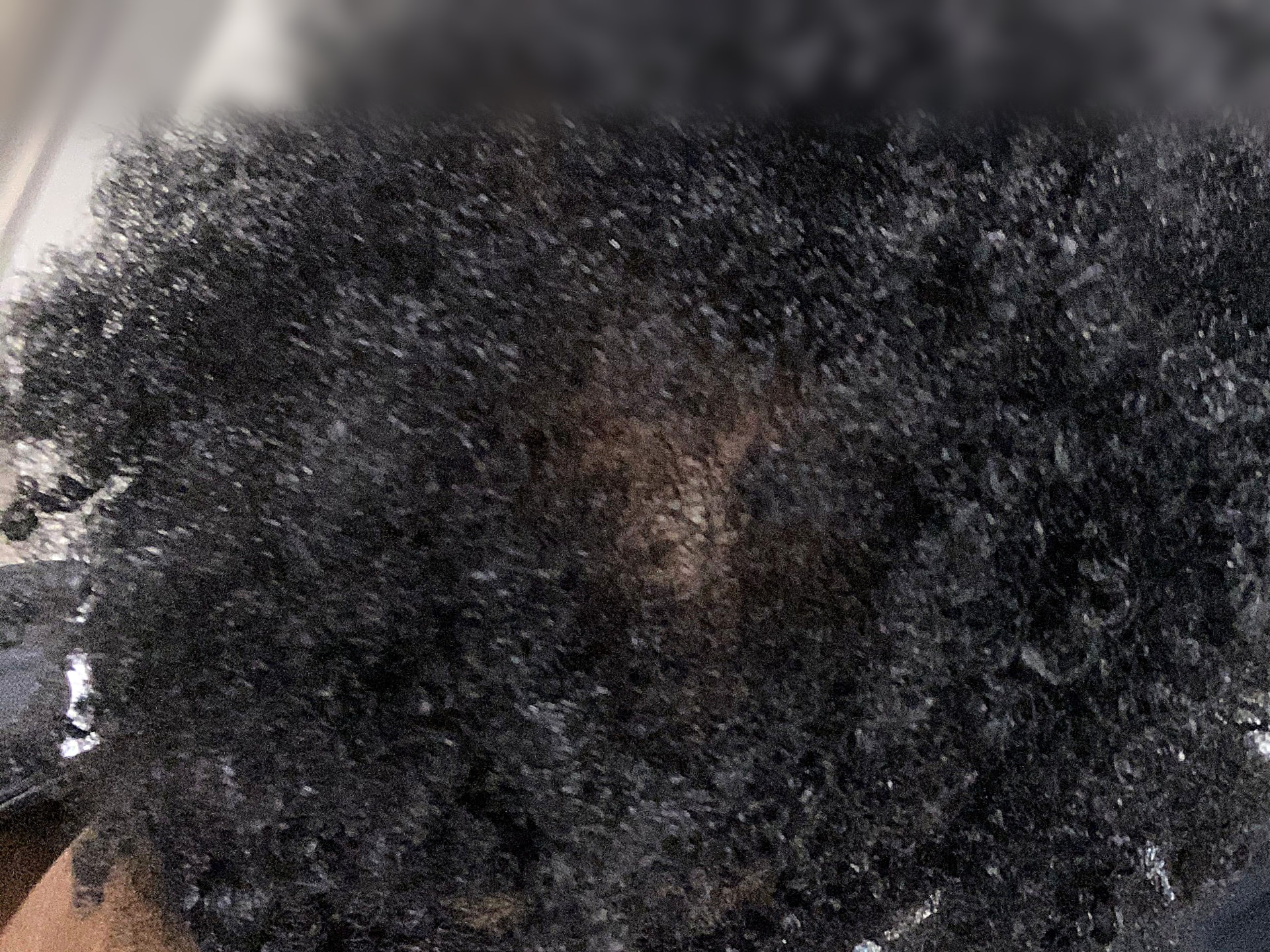 Close-up of a thinning hair patch at the crown, January 2021